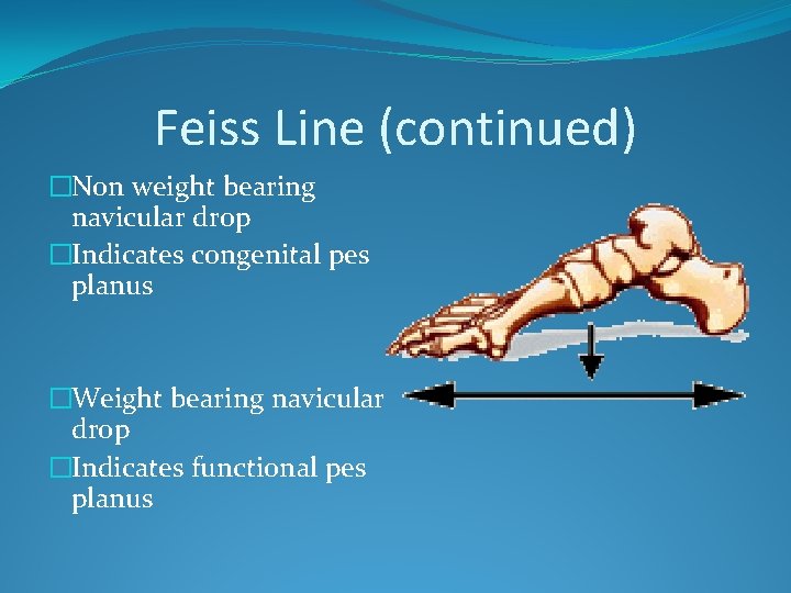Feiss Line (continued) �Non weight bearing navicular drop �Indicates congenital pes planus �Weight bearing