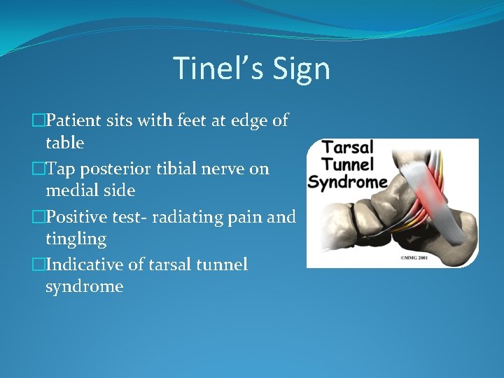 Tinel’s Sign �Patient sits with feet at edge of table �Tap posterior tibial nerve