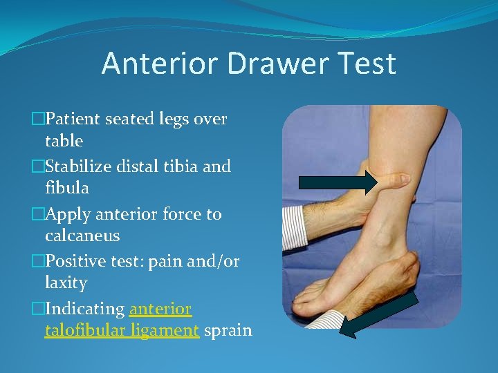 Anterior Drawer Test �Patient seated legs over table �Stabilize distal tibia and fibula �Apply