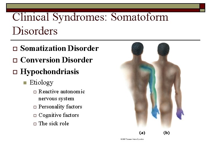 Clinical Syndromes: Somatoform Disorders o o o Somatization Disorder Conversion Disorder Hypochondriasis n Etiology