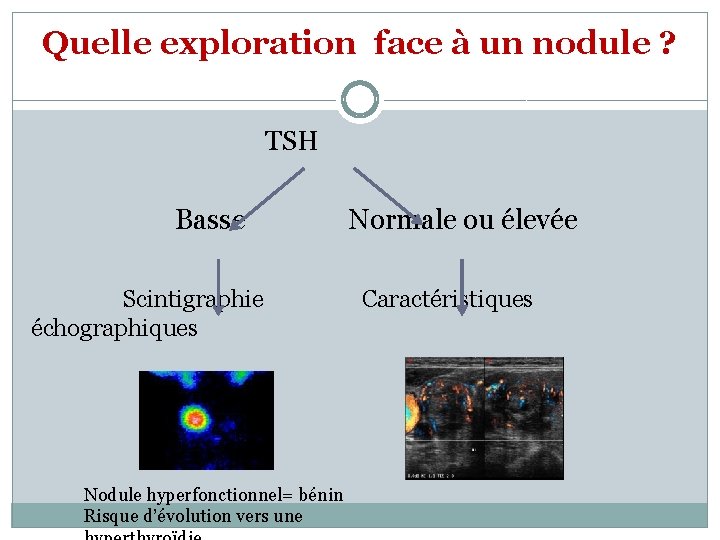 Quelle exploration face à un nodule ? TSH Basse Scintigraphie échographiques Nodule hyperfonctionnel= bénin