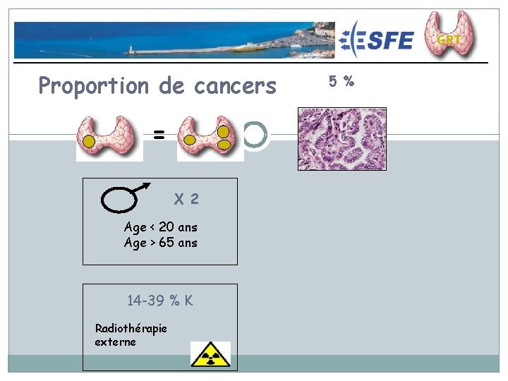 Consensus Nodules Thyroïdiens - 2009 Proportion de cancers = X 2 Age < 20