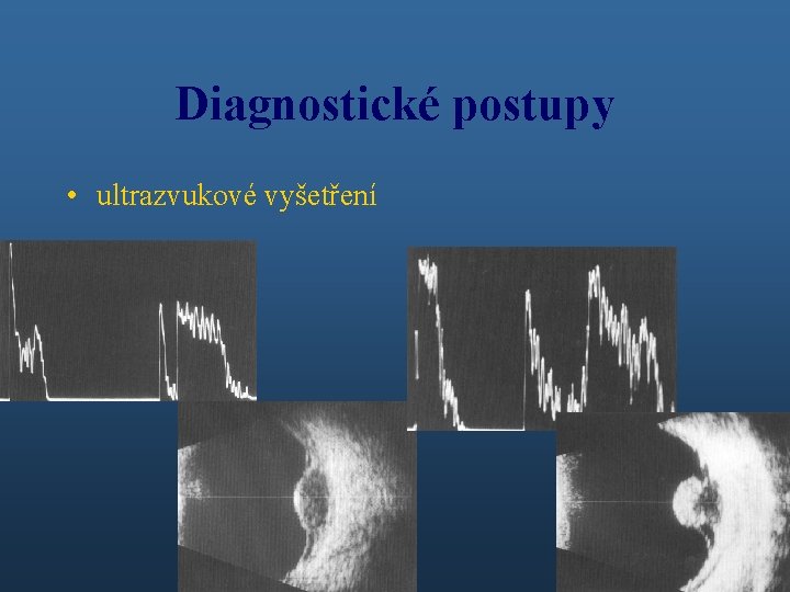 Diagnostické postupy • ultrazvukové vyšetření 
