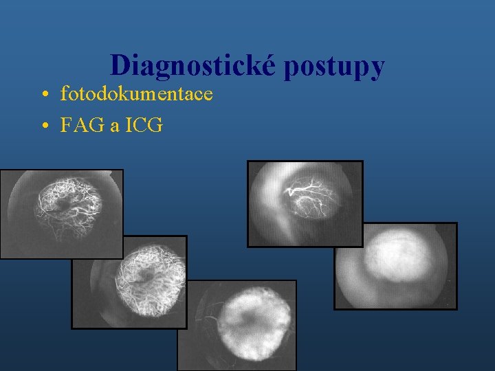 Diagnostické postupy • fotodokumentace • FAG a ICG 