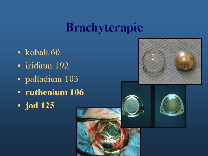 Brachyterapie • • • kobalt 60 iridium 192 palladium 103 ruthenium 106 jod 125