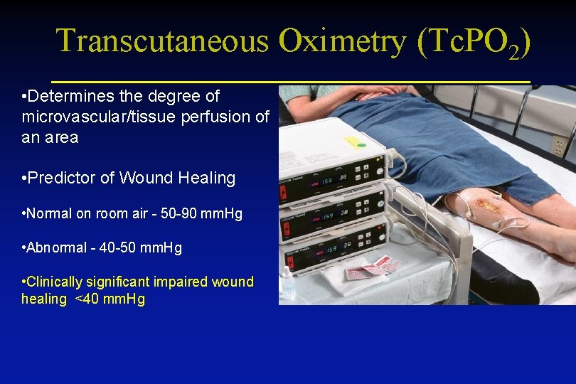 Transcutaneous Oximetry (Tc. PO 2) • Determines the degree of microvascular/tissue perfusion of an