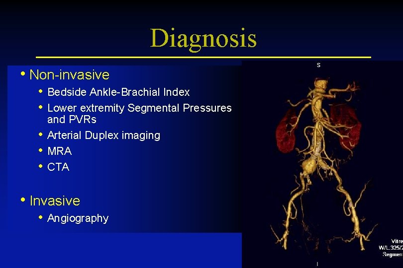 Diagnosis • Non-invasive • Bedside Ankle-Brachial Index • Lower extremity Segmental Pressures • •
