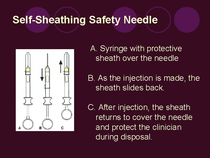 Self-Sheathing Safety Needle A. Syringe with protective sheath over the needle B. As the