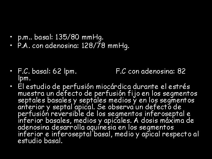  • p. m. . basal: 135/80 mm. Hg. • P. A. con adenosina: