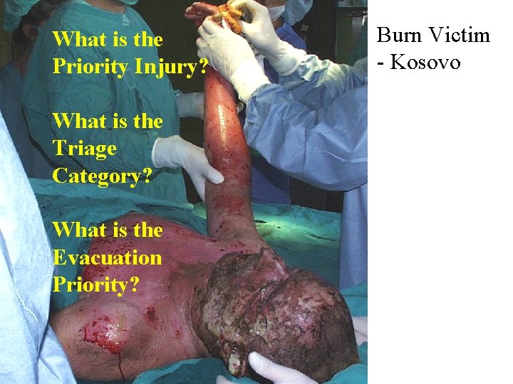 What is the Priority Injury? What is the Triage Category? What is the Evacuation