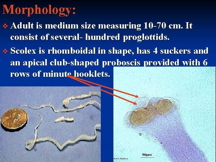 Morphology: v Adult is medium size measuring 10 -70 cm. It consist of several-