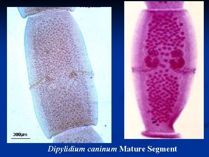 Dipylidium caninum Mature Segment 