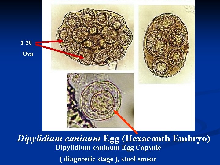 1 -20 Ova Iodine stain Dipylidium caninum Egg (Hexacanth Embryo) Dipylidium caninum Egg Capsule