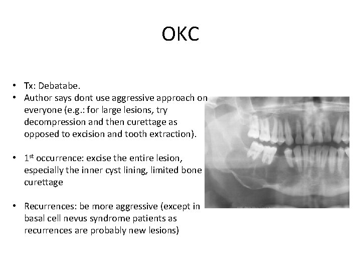 OKC • Tx: Debatabe. • Author says dont use aggressive approach on everyone (e.