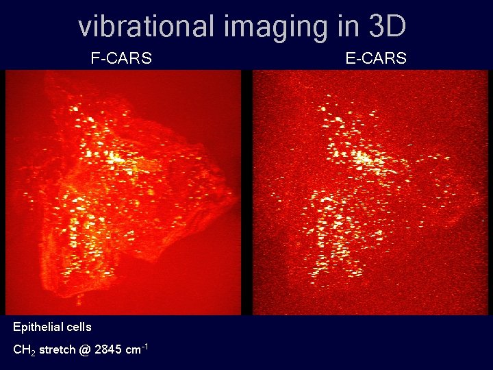 vibrational imaging in 3 D F-CARS Epithelial cells CH 2 stretch @ 2845 cm-1