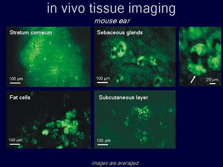 in vivo tissue imaging mouse ear Stratum corneum Fat cells Sebaceous glands Subcutaneous layer