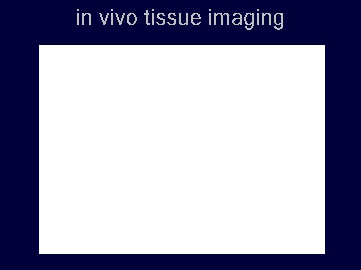 in vivo tissue imaging 