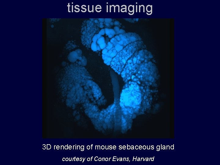 tissue imaging 3 D rendering of mouse sebaceous gland courtesy of Conor Evans, Harvard
