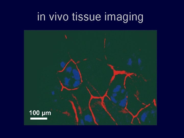 in vivo tissue imaging 