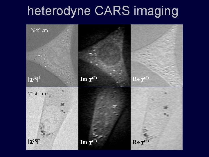 heterodyne CARS imaging 2845 cm-1 | (3)|2 Im (3) Re (3) 2950 cm-1 |