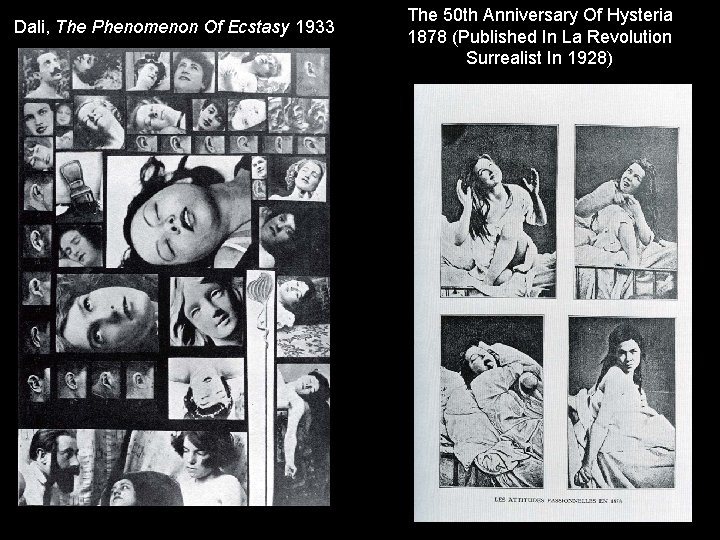 Dali, The Phenomenon Of Ecstasy 1933 The 50 th Anniversary Of Hysteria 1878 (Published