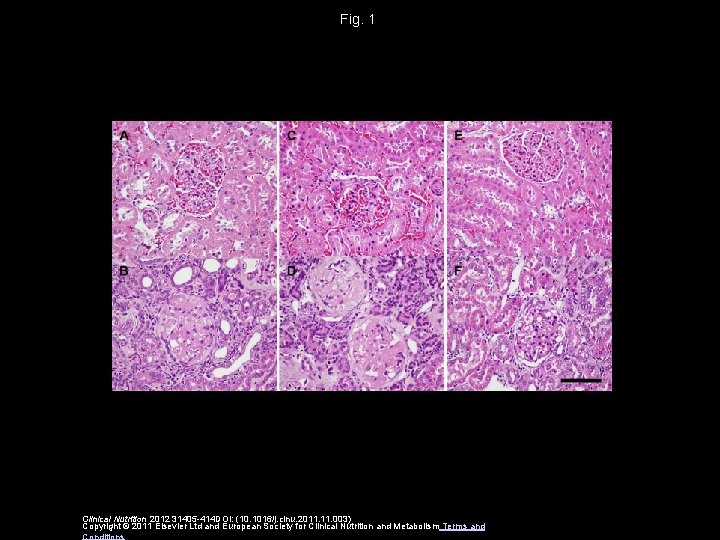 Fig. 1 Clinical Nutrition 2012 31405 -414 DOI: (10. 1016/j. clnu. 2011. 003) Copyright