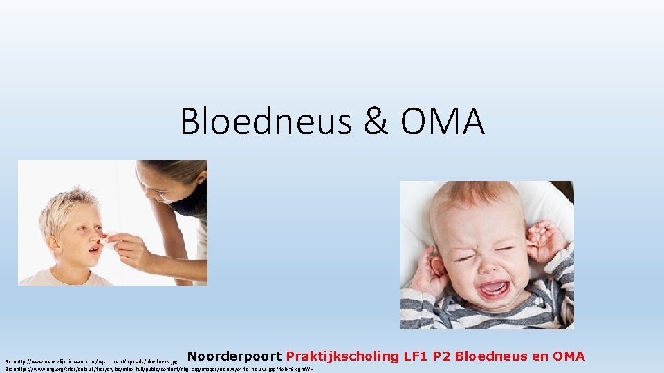 Bloedneus & OMA Noorderpoort Praktijkscholing LF 1 P 2 Bloedneus en OMA Bronhttp: //www.