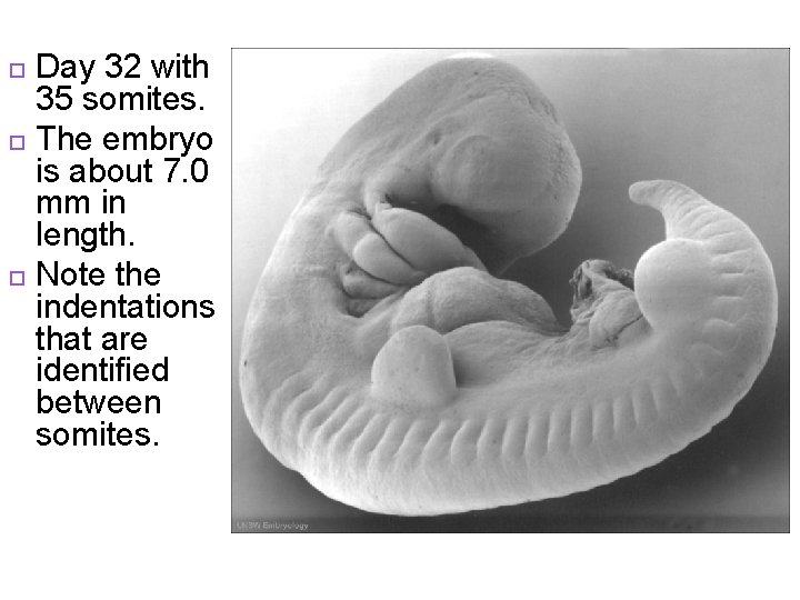 Day 32 with 35 somites. The embryo is about 7. 0 mm in length.