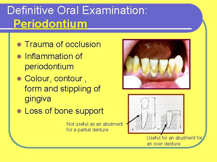 Definitive Oral Examination: Periodontium Trauma of occlusion l Inflammation of periodontium l Colour, contour