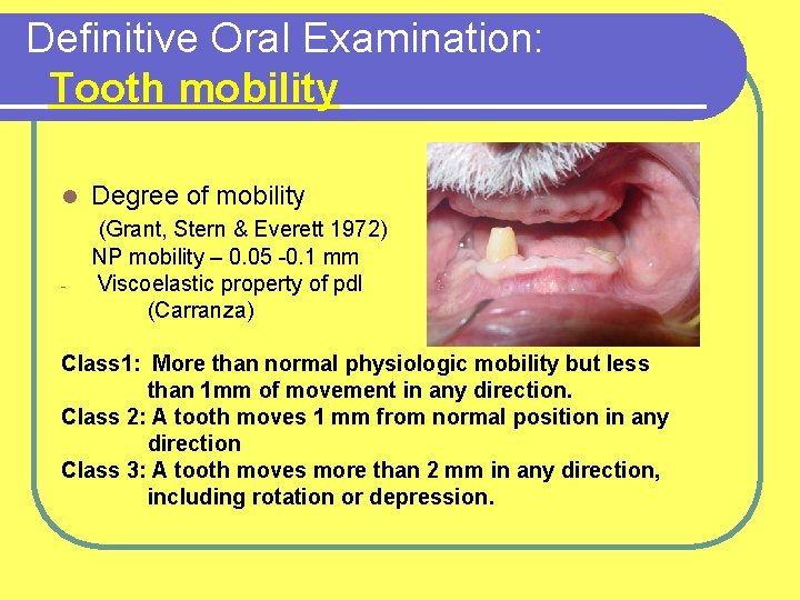 Definitive Oral Examination: Tooth mobility l - Degree of mobility (Grant, Stern & Everett
