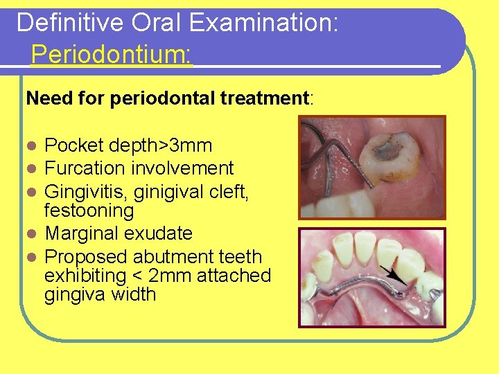 Definitive Oral Examination: Periodontium: Need for periodontal treatment: Pocket depth>3 mm Furcation involvement Gingivitis,