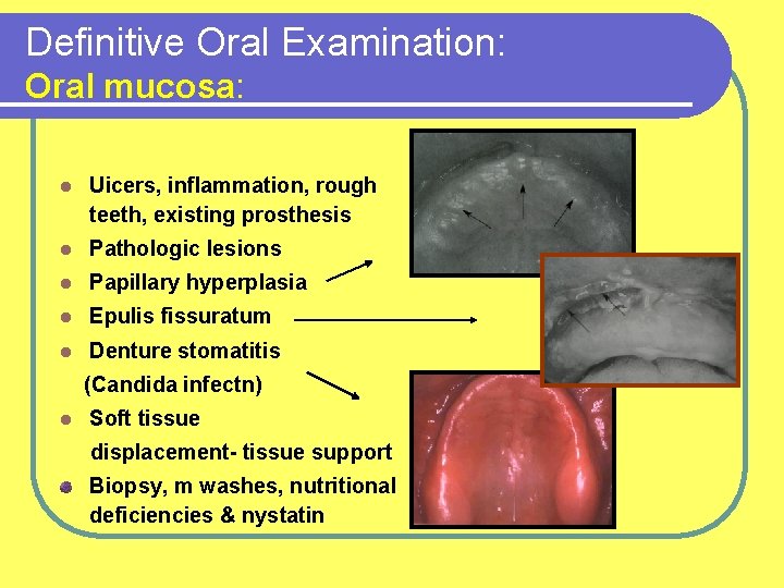 Definitive Oral Examination: Oral mucosa: l Uicers, inflammation, rough teeth, existing prosthesis l Pathologic