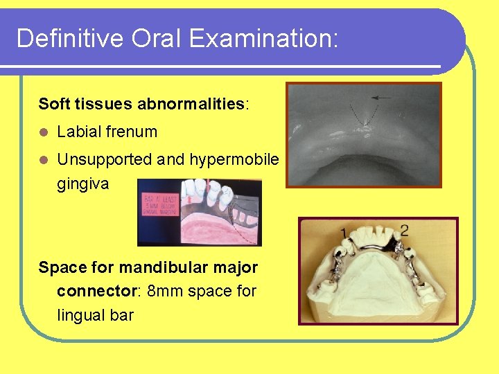 Definitive Oral Examination: Soft tissues abnormalities: l Labial frenum l Unsupported and hypermobile gingiva