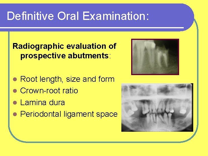 Definitive Oral Examination: Radiographic evaluation of prospective abutments: Root length, size and form l