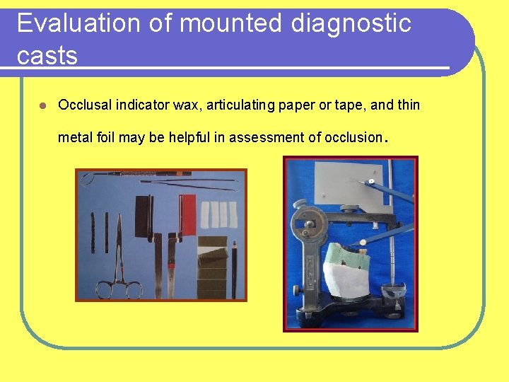 Evaluation of mounted diagnostic casts l Occlusal indicator wax, articulating paper or tape, and