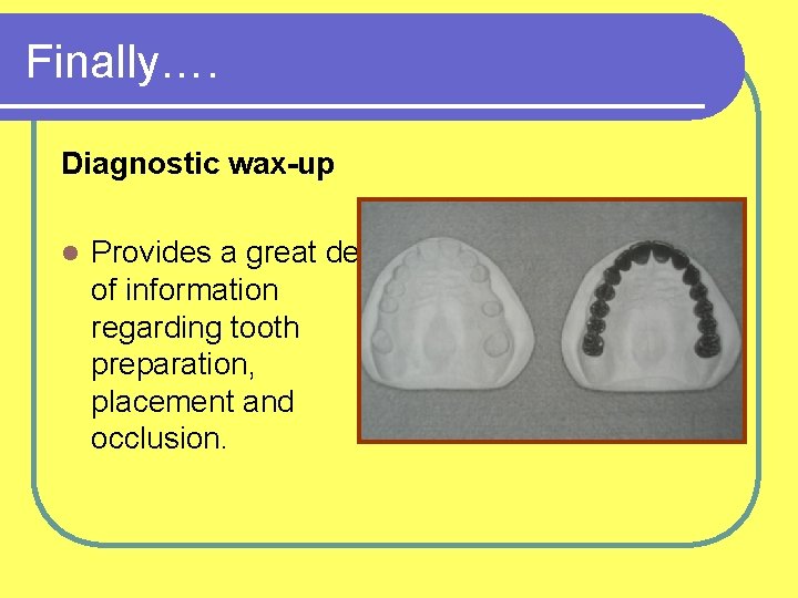 Finally…. Diagnostic wax-up l Provides a great deal of information regarding tooth preparation, placement