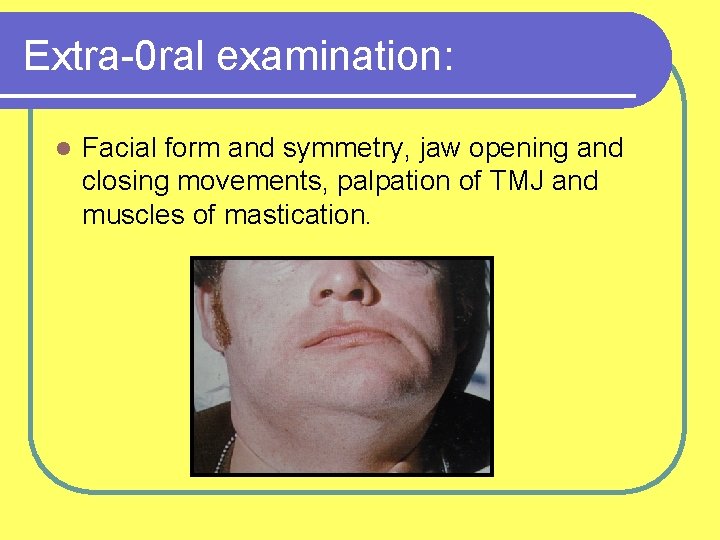 Extra-0 ral examination: l Facial form and symmetry, jaw opening and closing movements, palpation