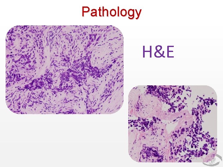 Pathology H&E Pathology H&E