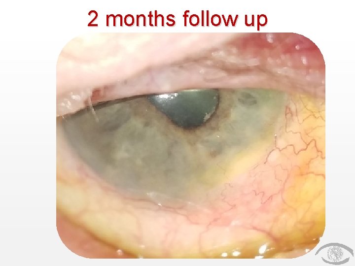 2 months follow up 2 months follow up