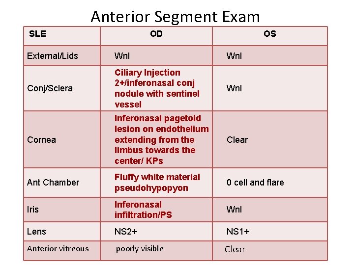Anterior Segment Exam SLE OD OS External/Lids Wnl Conj/Sclera Ciliary Injection 2+/inferonasal conj nodule Anterior Segment Exam SLE OD OS External/Lids Wnl Conj/Sclera Ciliary Injection 2+/inferonasal conj nodule