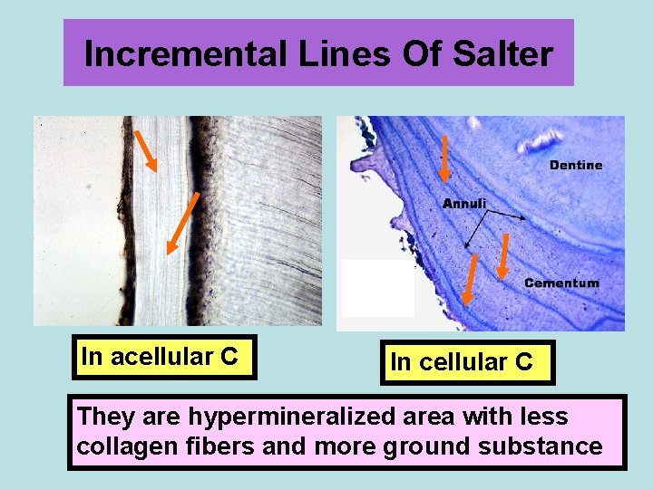 Incremental Lines Of Salter In acellular C In cellular C They are hypermineralized area