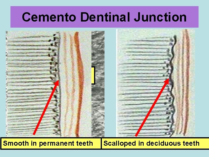Cemento Dentinal Junction D C Smooth in permanent teeth Scalloped in deciduous teeth 