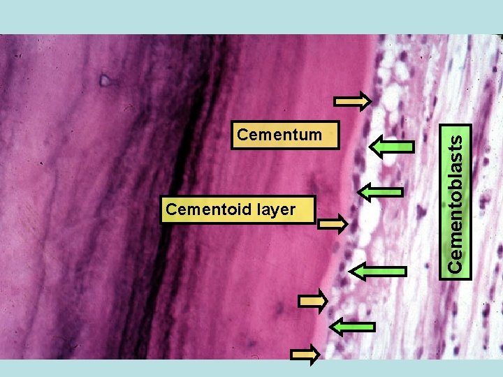 Cementoid layer Cementoblasts Cementum 