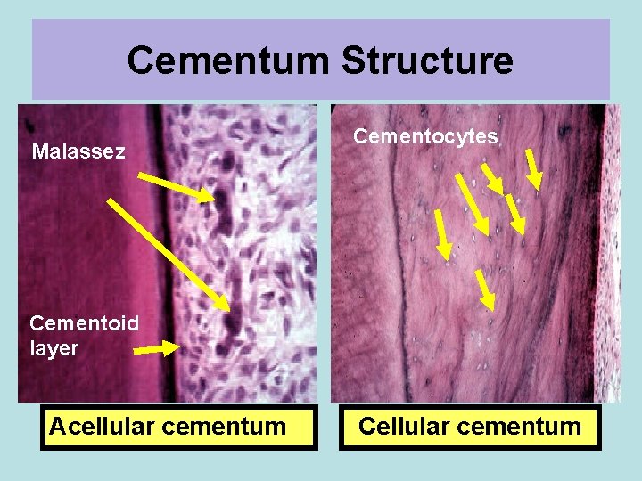 Cementum Structure Malassez Cementocytes Cementoid layer Acellular cementum Cellular cementum 