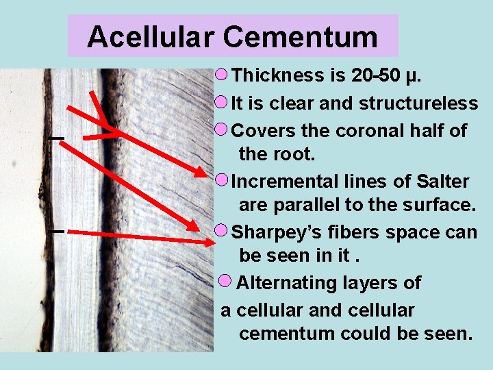 Acellular Cementum Thickness is 20 -50 µ. It is clear and structureless Covers the