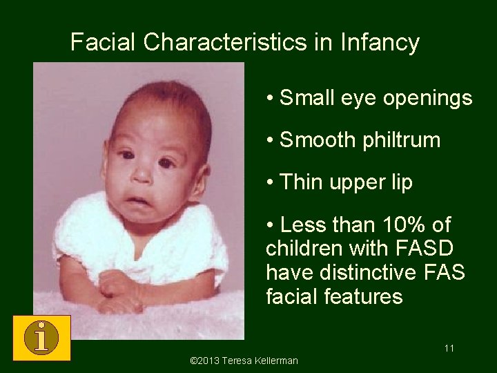 Facial Characteristics in Infancy • Small eye openings • Smooth philtrum • Thin upper