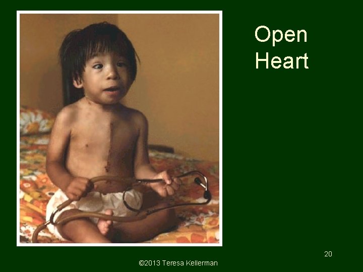 Open Heart 20 © 2013 Teresa Kellerman 