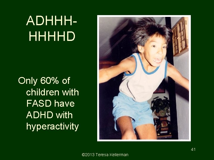 ADHHHHHHHD Only 60% of children with FASD have ADHD with hyperactivity 41 © 2013