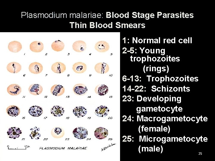 Plasmodium malariae: Blood Stage Parasites Thin Blood Smears 1: Normal red cell 2 -5: