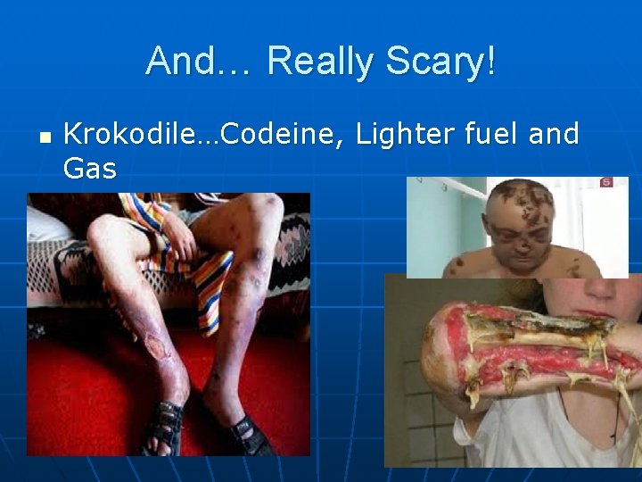And… Really Scary! n Krokodile…Codeine, Lighter fuel and Gas 